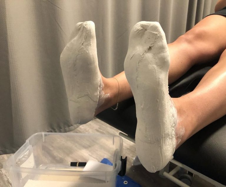 Custom Orthotic Fitting Physiotherapy Winnipeg Motion Science